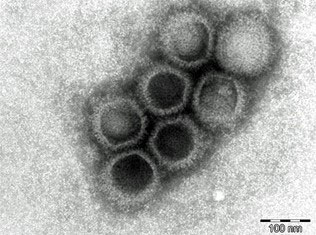 Viruspartikel des Suid Herpesvirus 1 unter dem Transmissions-Elektronen�mikroskop, 200.000-fache Vergr��erung.