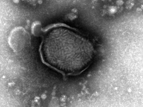 Abbildung 3: Pockenvirus im TEM.