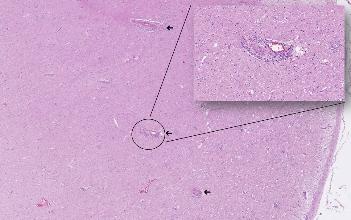 Histologisches Bild des Stammhirns.