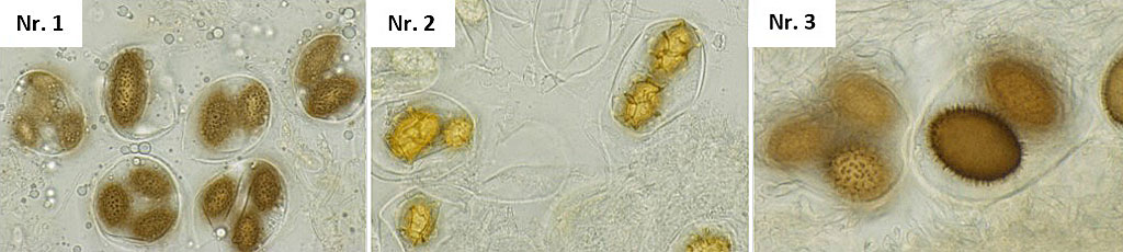  Abbildung 5: Sporen der Trüffel; Nr. 1 und Nr. 3: T. melanosporum (mit kurzen Stacheln); Nr. 2: T. aestivum (mit netzig-wabenartiger Ornamentierung).