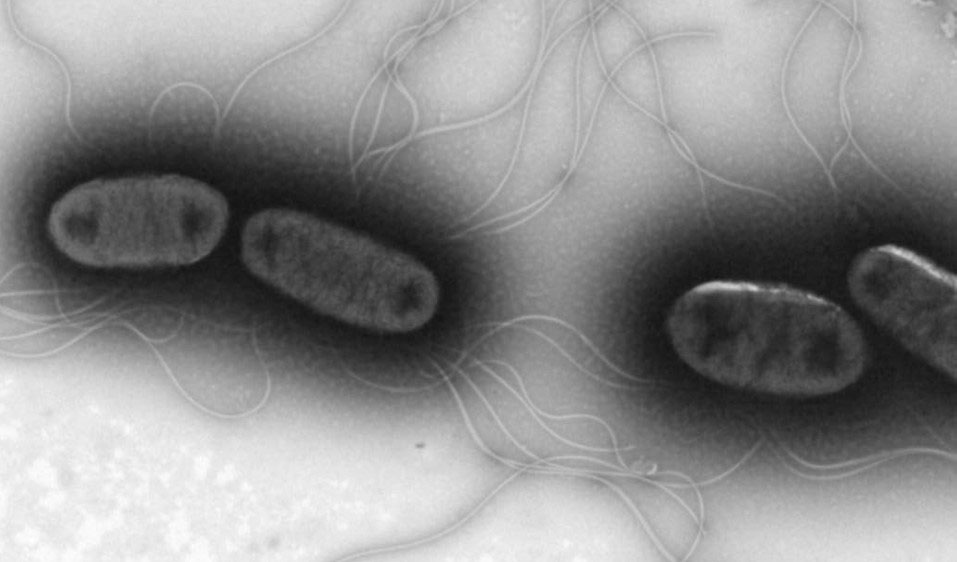 Abbildung 1: Salmonella Enteritidis unter dem Elektronenmikroskop, 20.000fache Vergrößerung.