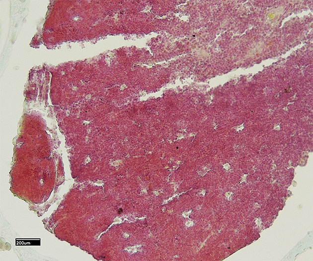 Histologisches Pr�parat: Milzgewebe in Leberwurst.