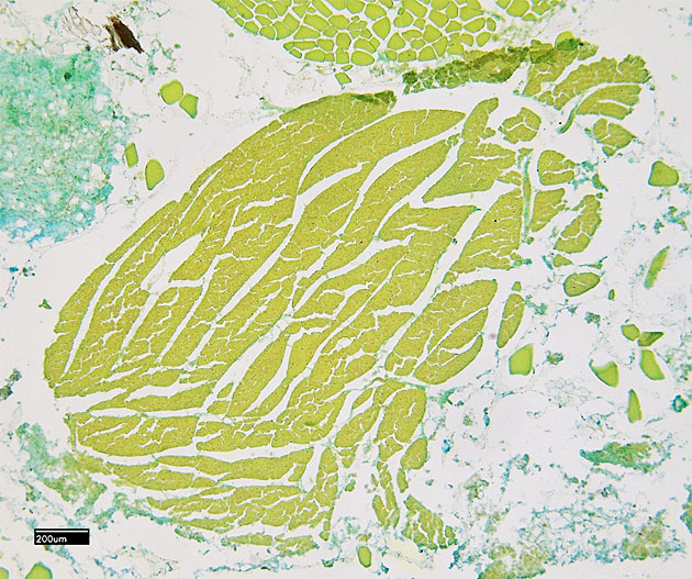 Histologisches Pr�parat: Herzmuskulatur in Leberwurst (Herzmuskelzellen hellgr�n mit roten Zellkernen).